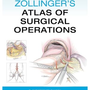 Zollinger’s Atlas of Surgical Operations