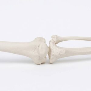 Plastic Lower Limb Bone Model